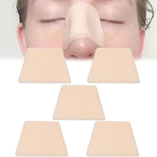 External Nasal Splint